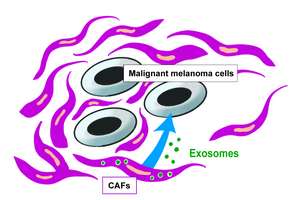 Exosomes from cancer-associated fibroblasts may suppress malignant melanoma