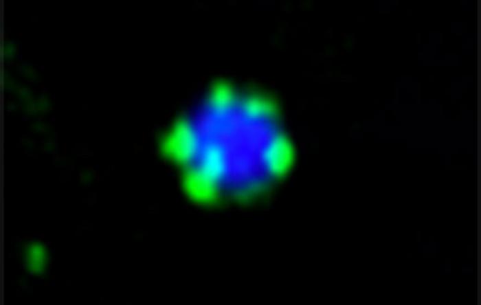 Under the fluorescence microscope: the Atg11 molecule (green) forms small droplets on the surface of a protein aggregate (blue).