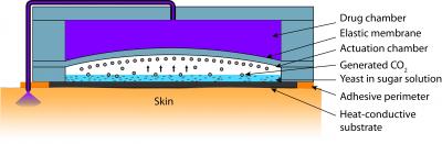 Pump Activated By Body Heat