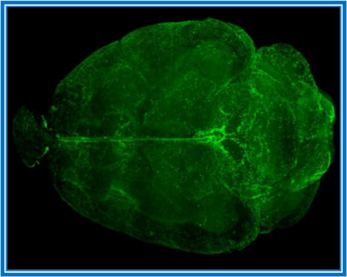 Fig. 1. Lyve-1 immunostained lymphatic vessels on the surface of a cleared brain