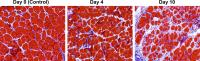 Fibrosis in Muscular Dystrophy