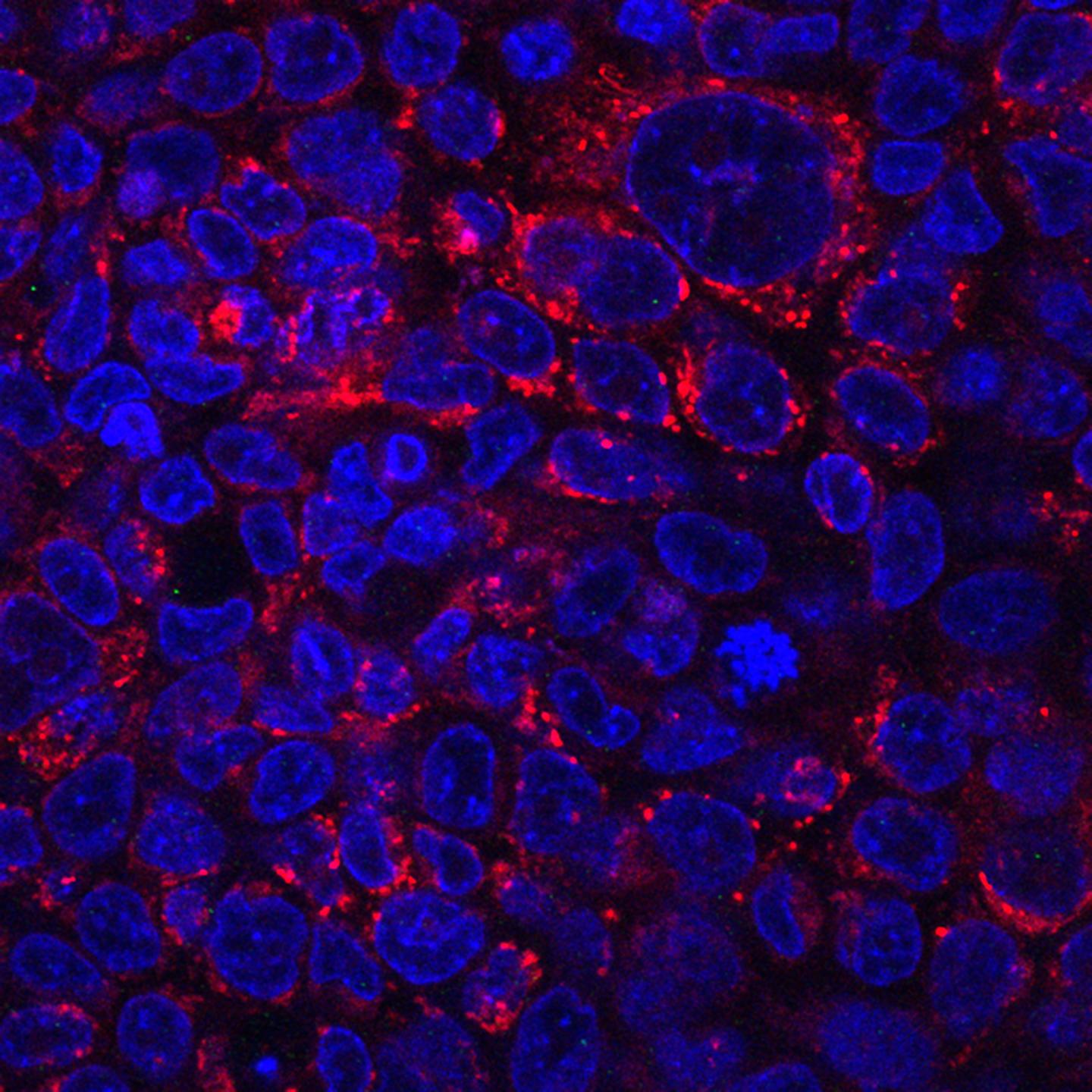 CK1&alpha;: The Achilles Heel of RAS-Driven Cancer Cells
