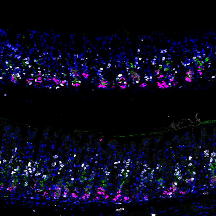 Normal epithelium vs. p57 overexpression dpi3