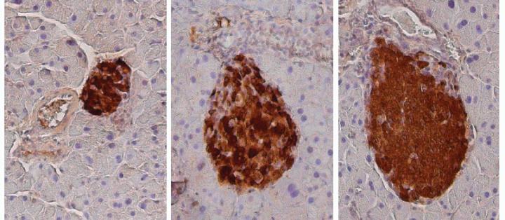 IGF-1 Suppresses Type-1 Diabetes in Mice