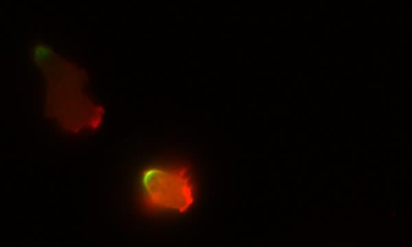 The Front and Back of Migrating Cells