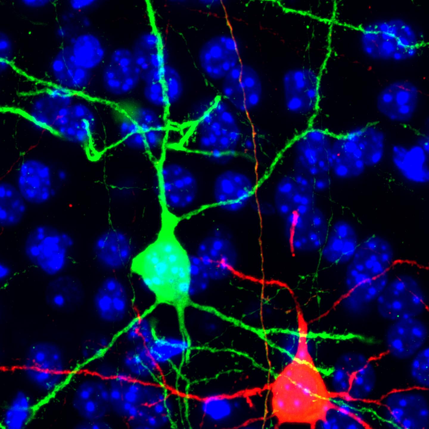 New Function for Potential Tumor Suppressor in Brain Development