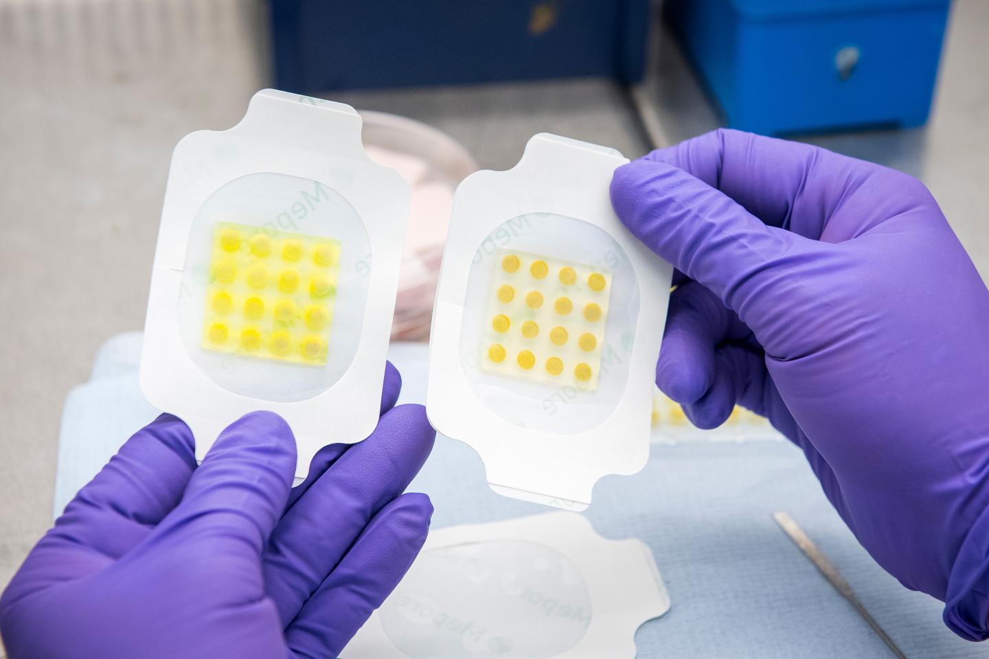 The Dressing, Activated and Inactivated