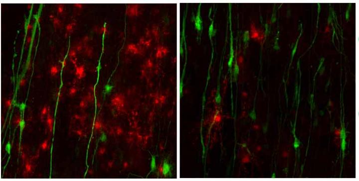 Astrocytes and Reduced Myelin