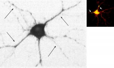 RNA-Associated Introns Guide Nerve-Cell Channel Production