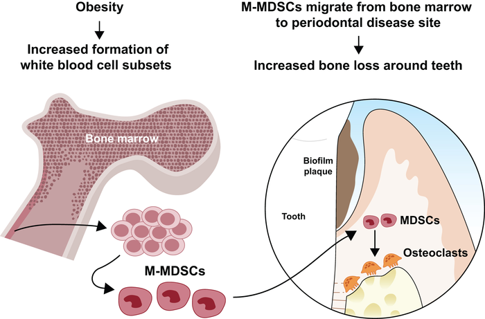 Obesity-Perio-Bone-Loss-final-HI