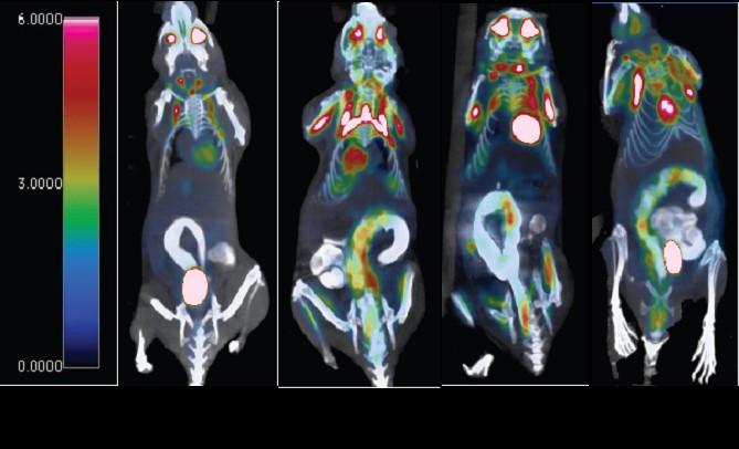 New Research on Probiotics in the Prevention and Treatment of Colon Cancer