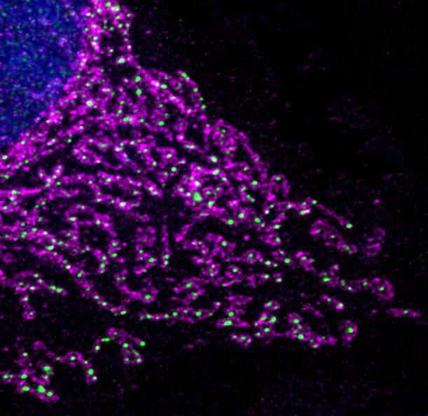 Mitochondria Networks