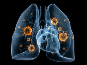 Lung Infection Illustration