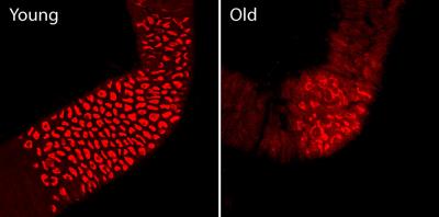 Age-Related Gastric Decline in <em>Drosophila</em>