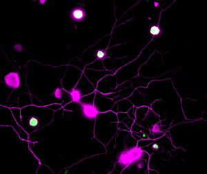 Visualizing pain in mouse sensory neurons (I)