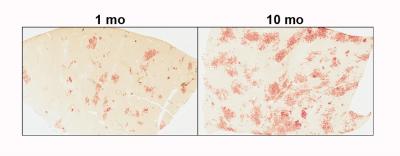 Transplanted Liver Cells
