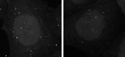 Alpha-synuclein Reduces Autophagosomes