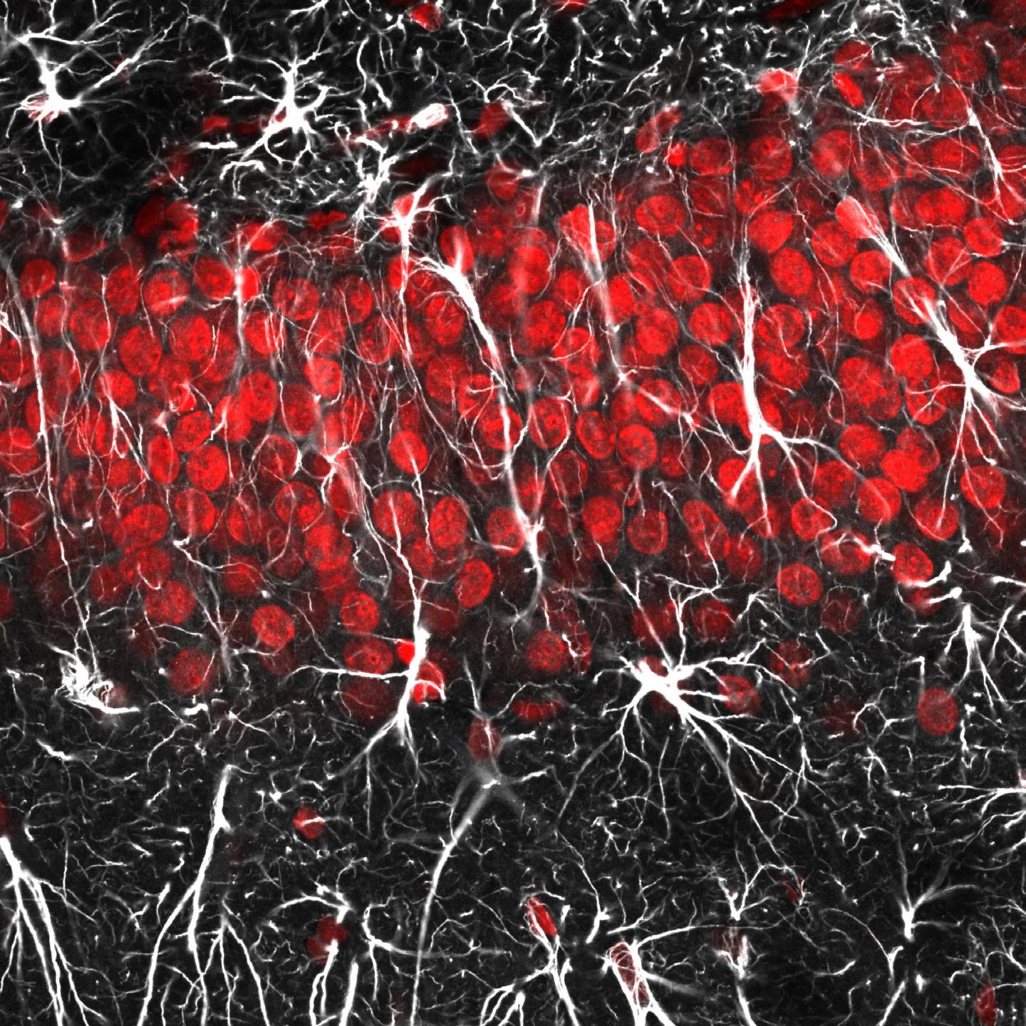 Every Bite You Take, Every Move You Make, Astrocytes Will Be Watching You (2 of 2)