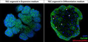 Microscopy images of mouse thymic epithelial cell (TEC) organoids