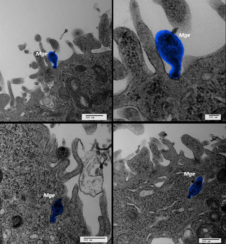 <i>Mycoplasma genitalium</i>'s Cell Adhesion Mechanism Revealed