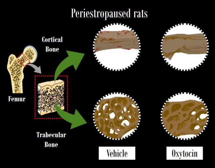 trabecular bone osteoporosis