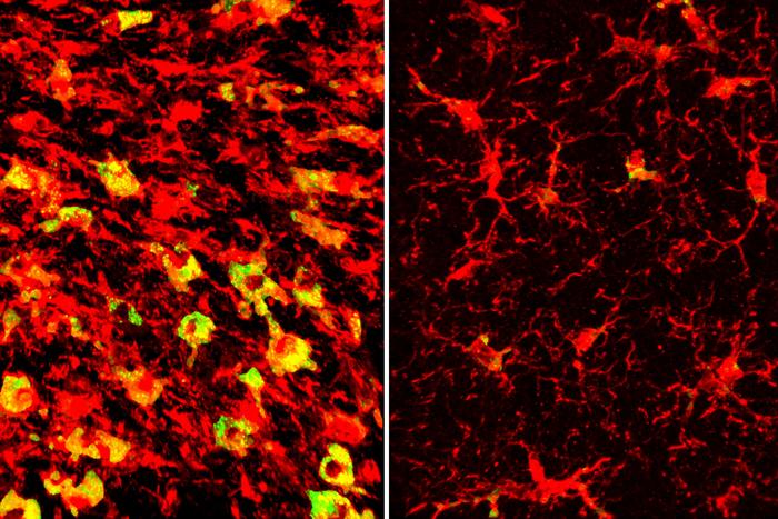 Lipids in microglia