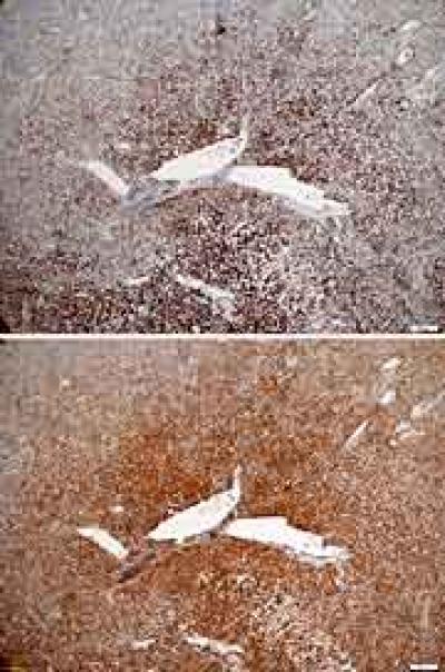 Activated mTORC1 Signaling