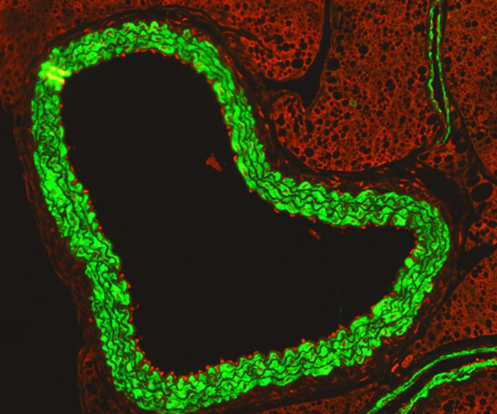 Influenza-infected aorta