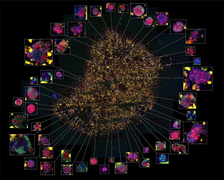 A High Magnification Image of Sediment Enriched in Syntrophic Consortia