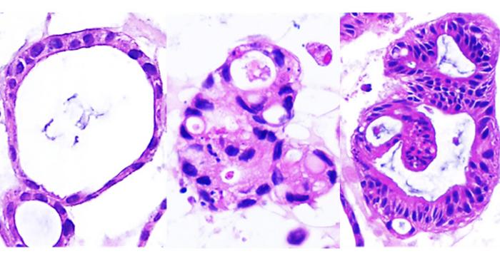 Organoids