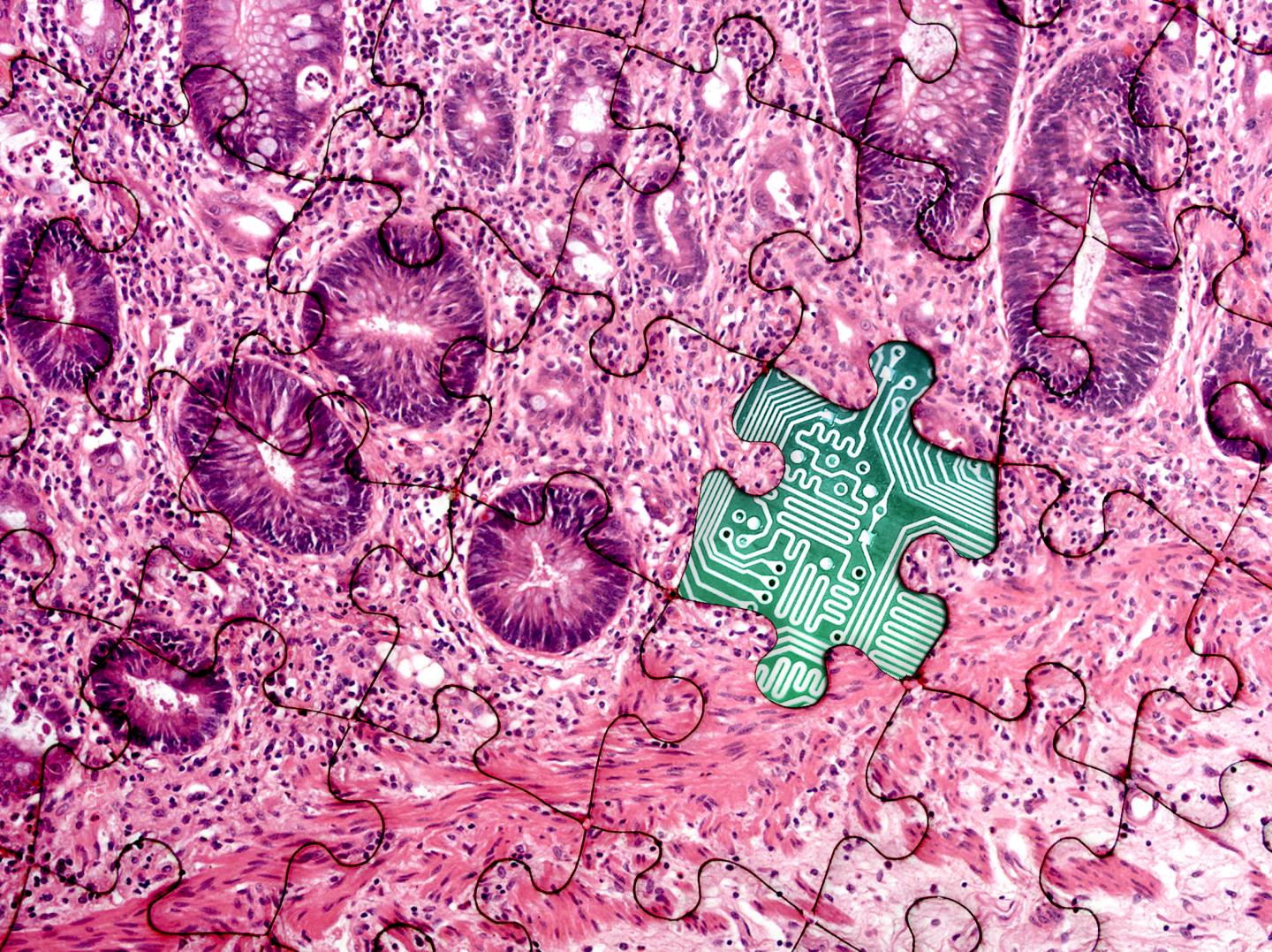 Digital Pathology