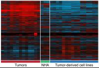 Heat Map Showing Differences in Gene Expression between Primary Tumors and Cultured Cell Lines