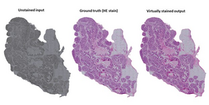 An example of virtual staining of tissue.