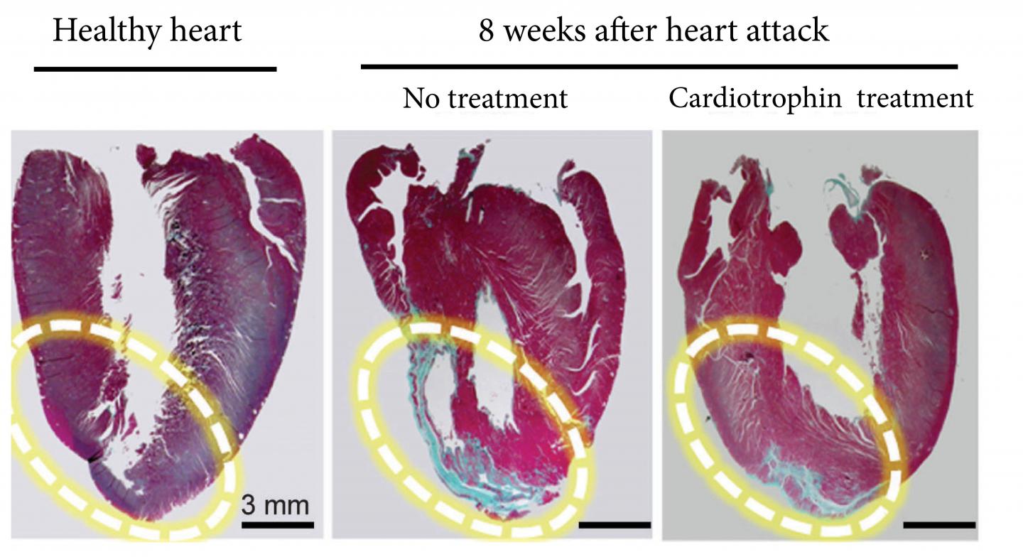 Cardiotrophin Improves Heart Health and Repairs Damage in Lab Models