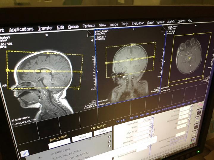 A baby next to fMRI images of its brain