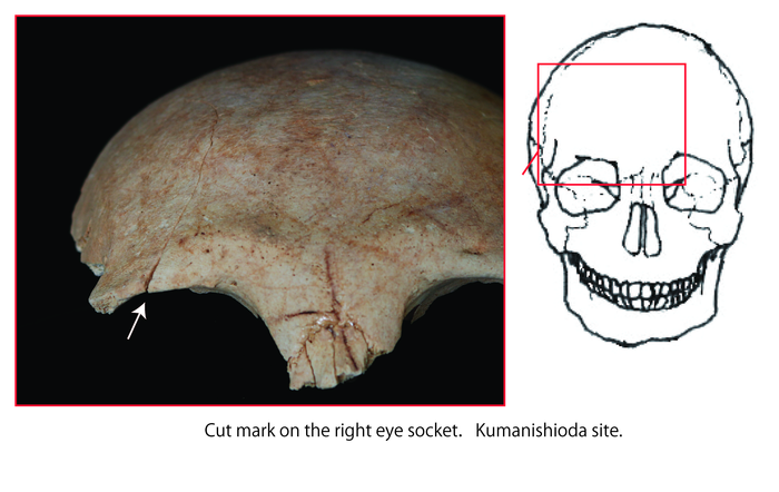 Picture showing cut mark on the right eye socket (Kumanishioda site)
