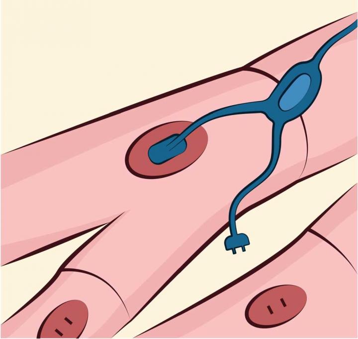 Electrophysiological Interactions between Macrophages and Cardiomyocytes