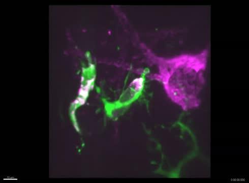 Feeding Microglia Cells
