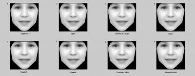 Computer-Aided Diagnosis of Rare Genetic Disorders
