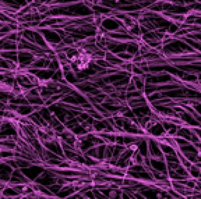 A Mat of Cilia in the Nasal Cavity