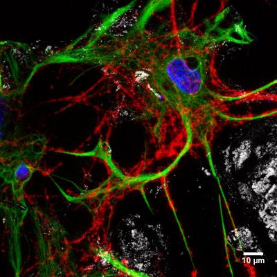 Confocal Reconstructions 