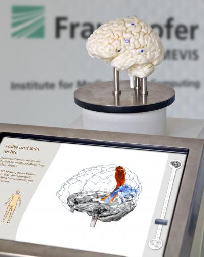 Fraunhofer MEVIS Neuro-Exhibit
