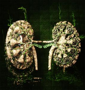 Kidney injury graphic