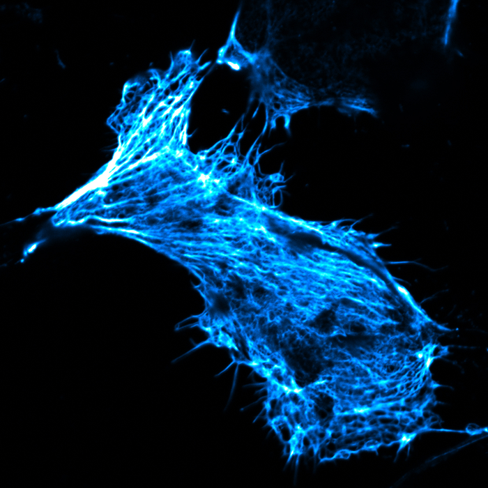 Microscope image of a living human cancer cell in culture. Its actin cytoskeleton has been stained with fluorescently labelled phalloidin. Scientists delivered this toxic substance into the cell using newly developed nanocontainers, and thus demonstrated that the containers can transport substances which usually cannot pass through cell membranes into cells.