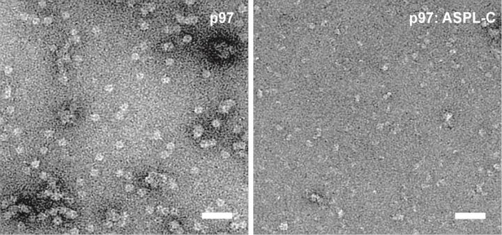 Electron Microscopy, Negative Stain