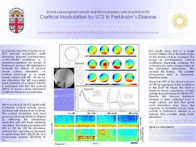 Poster Presentation by Ming Cheng