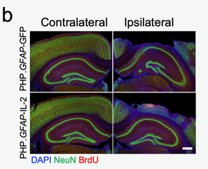 Immunofluorescence staining of mouse brain