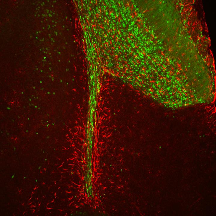 Making 'Scents' of New Cells in the Brain's Odor-Processing Area