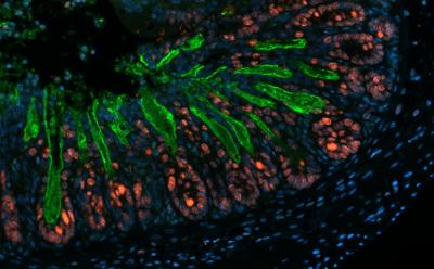 Striking Image (2 of 2)