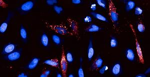 Human cells expressing the F13 poxvirus protein (red). Cell nuclei are shown in blue.